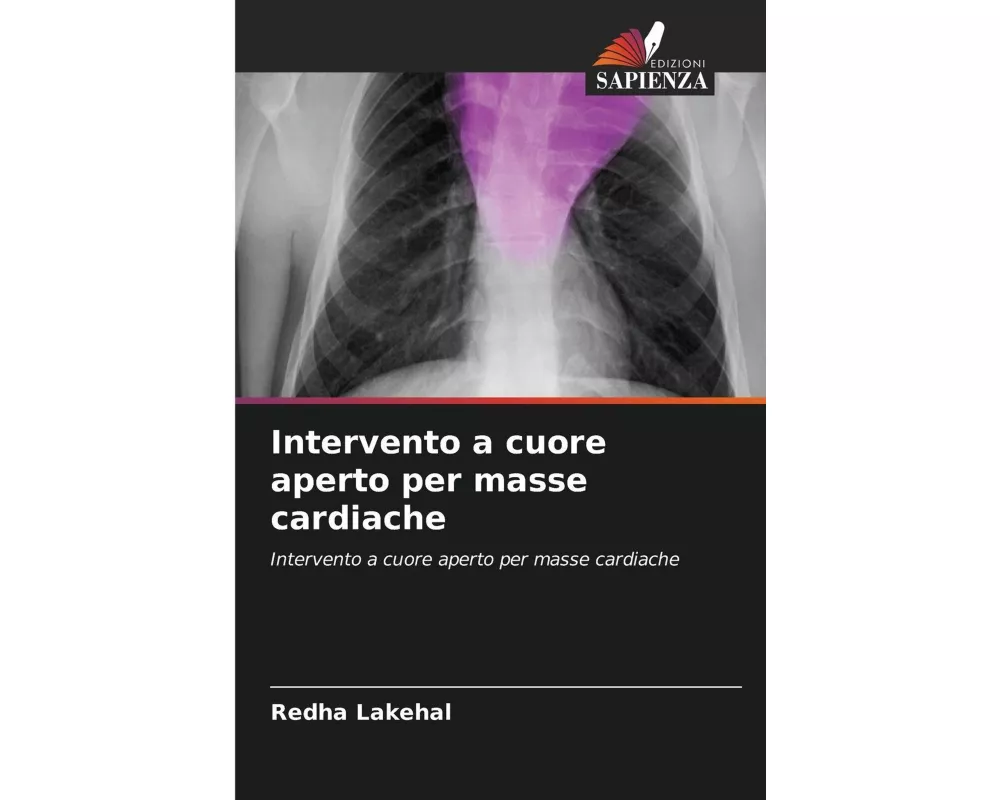 Intervento a cuore aperto per masse cardiache
