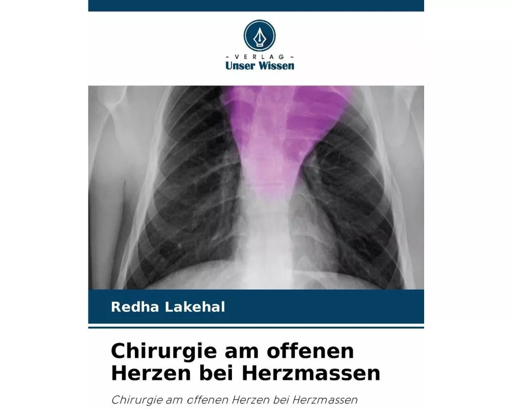 Chirurgie am offenen Herzen bei Herzmassen