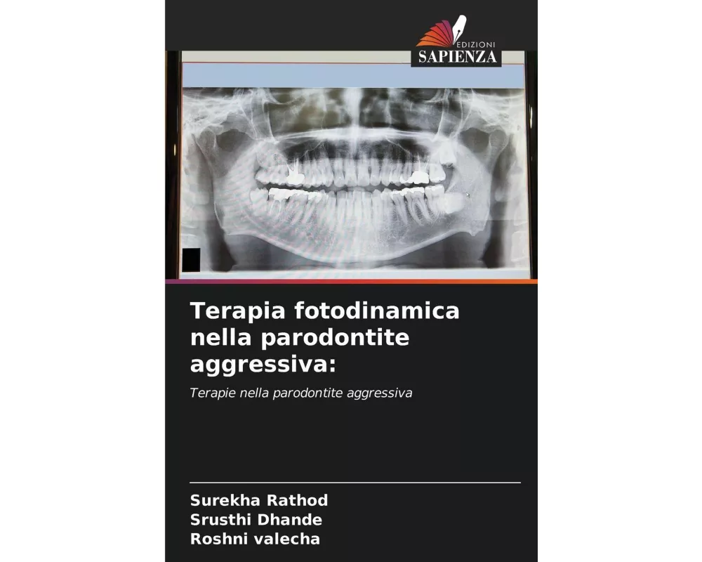 Terapia fotodinamica nella parodontite aggressiva