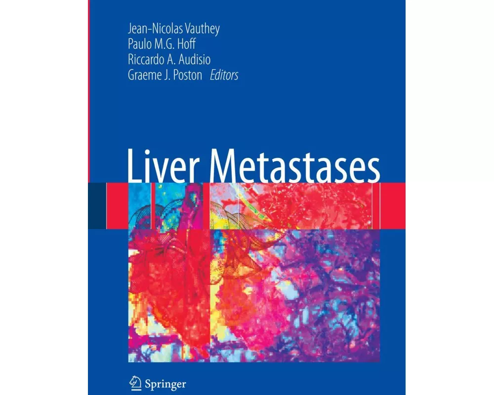 Liver Metastases