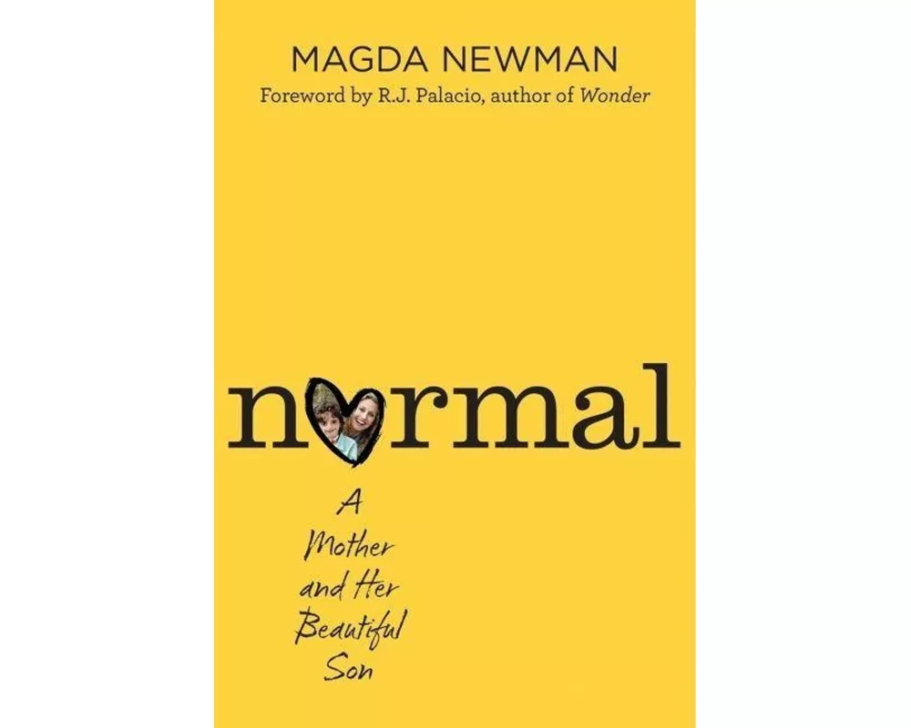 Normal