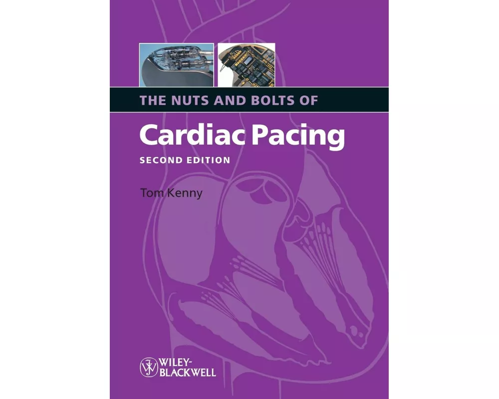 Nuts Bolts Cardiac Pacing 2e