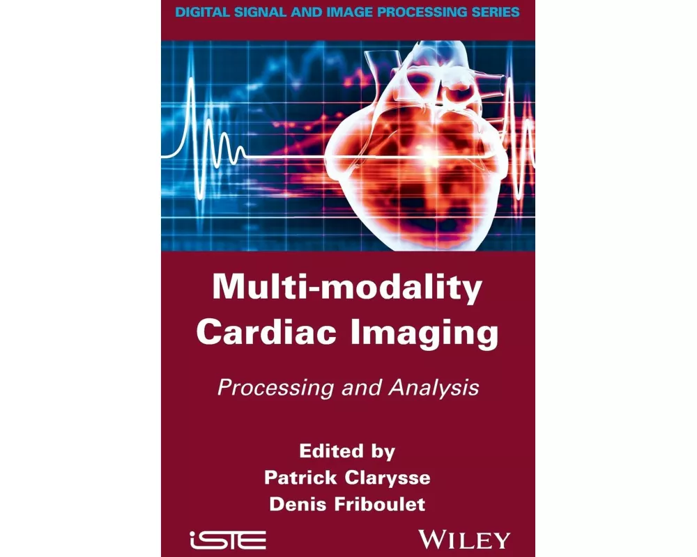 Multi-Modality Cardiac Imaging