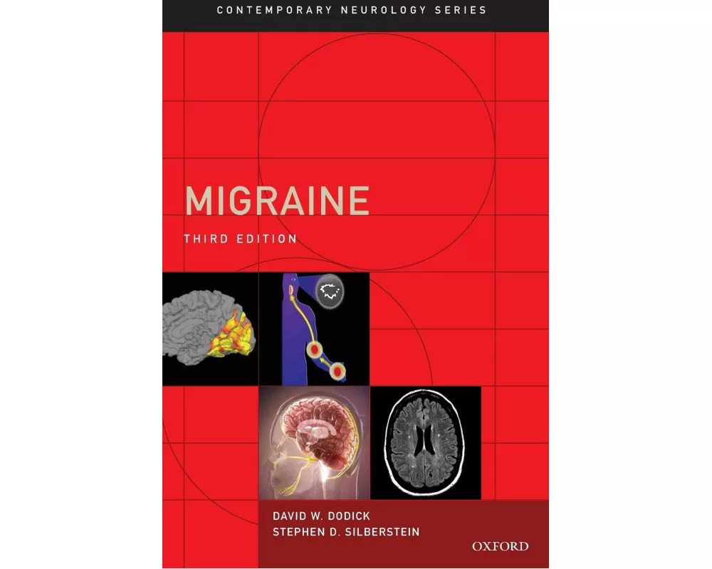 Migraine