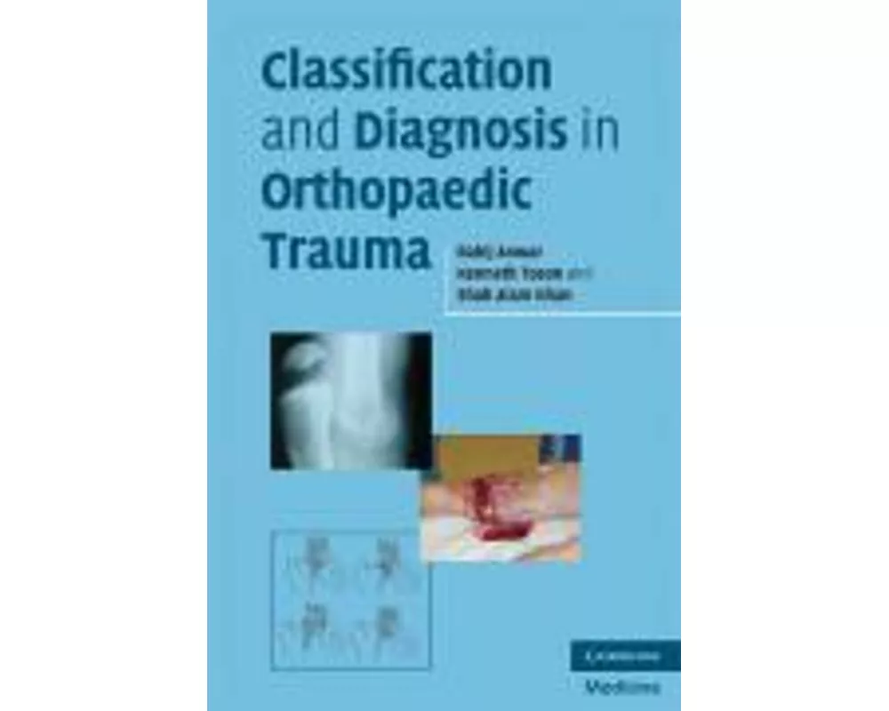 Classification and Diagnosis in Orthopaedic Trauma