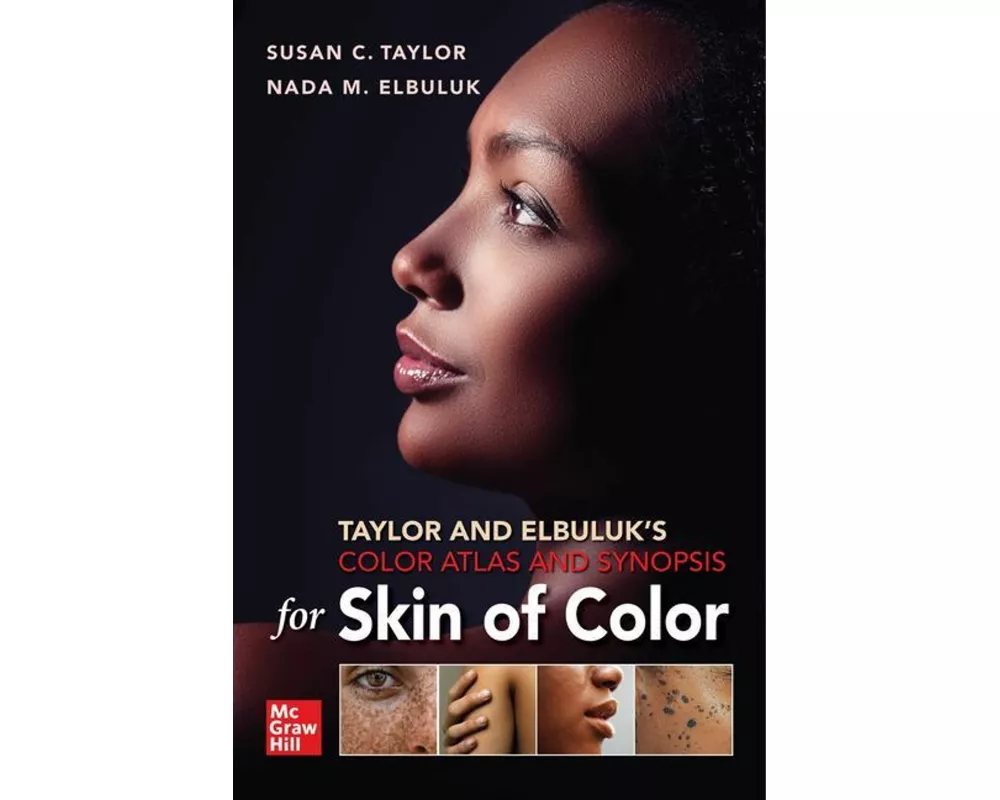 Taylor and Elbuluk's Color Atlas and Synopsis for Skin of Color