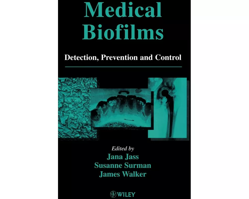 Medical Biofilms