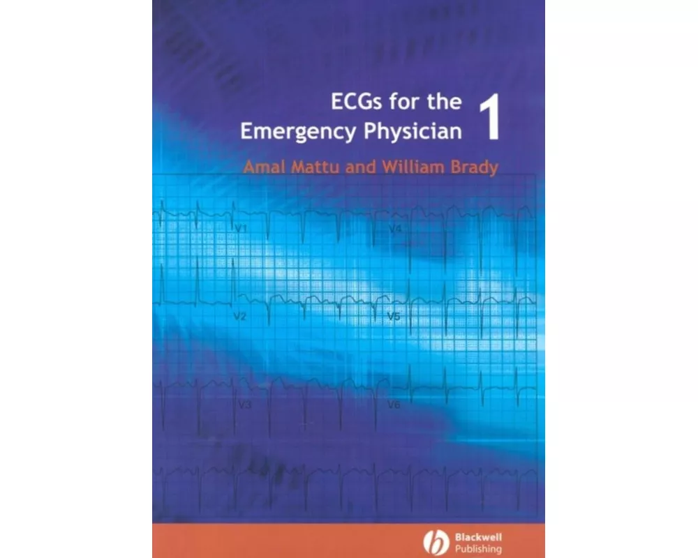 ECGs for the Emergency Physician 1