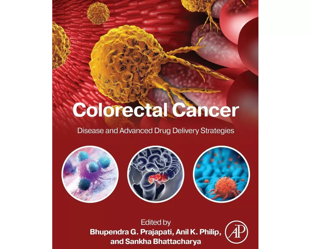 Colorectal Cancer