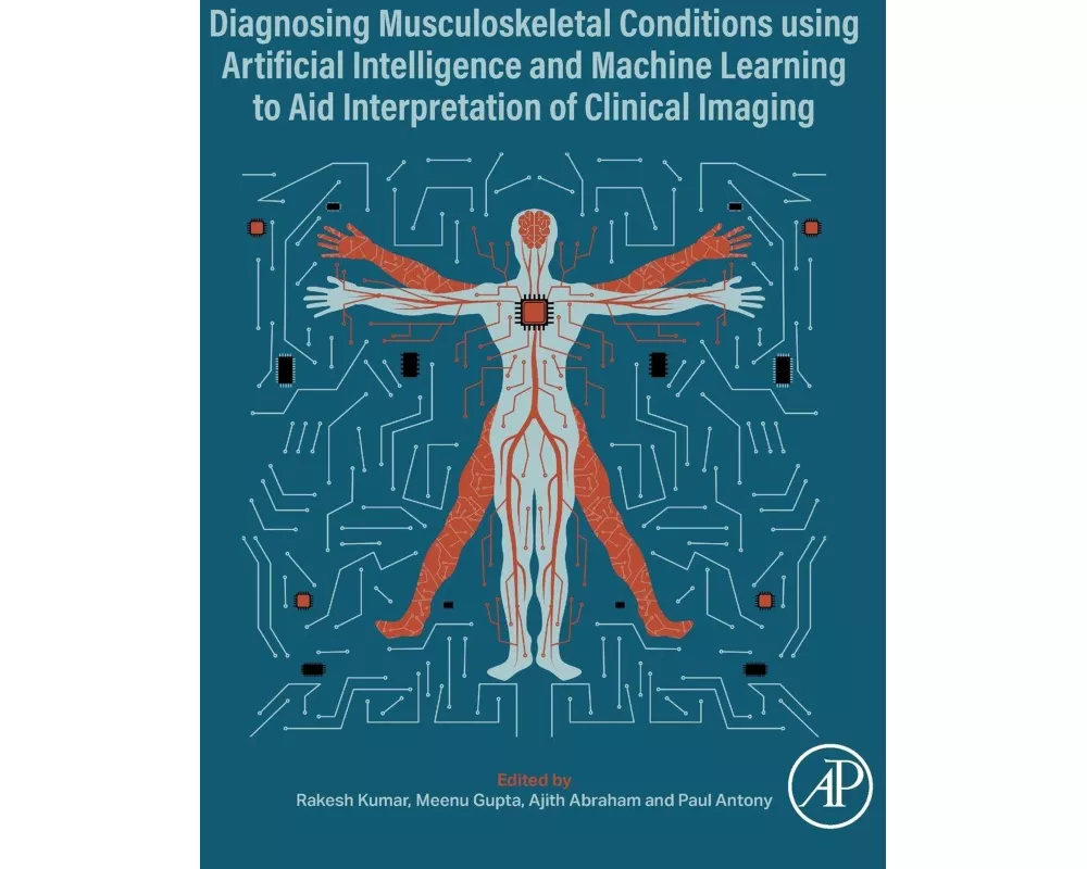 Diagnosing Musculoskeletal Conditions using Artifical Intelligence and Machine Learning to Aid Interpretation of Clinical Imaging