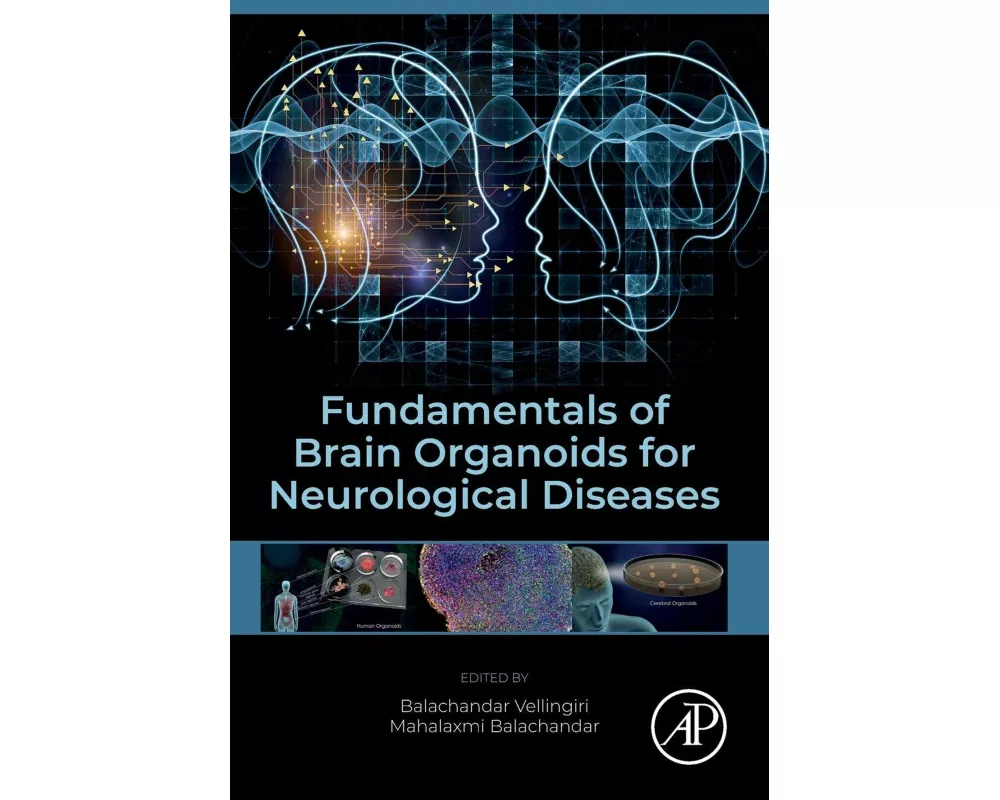Fundamentals of Brain Organoids for Neurological Diseases
