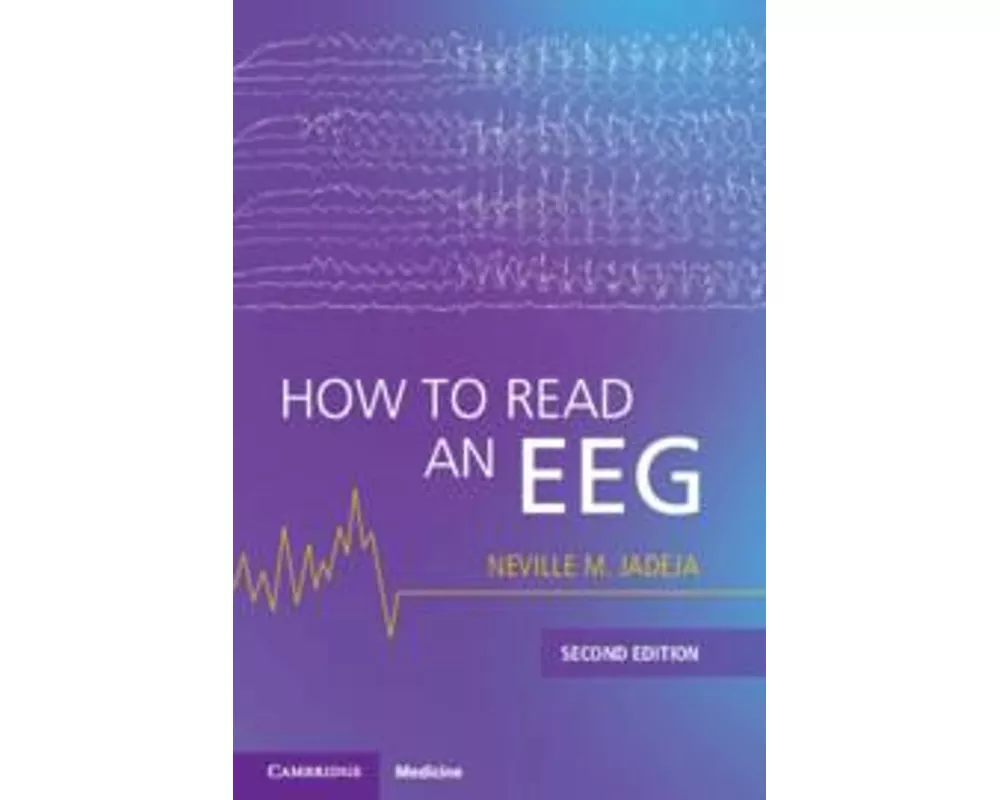 How to Read an EEG