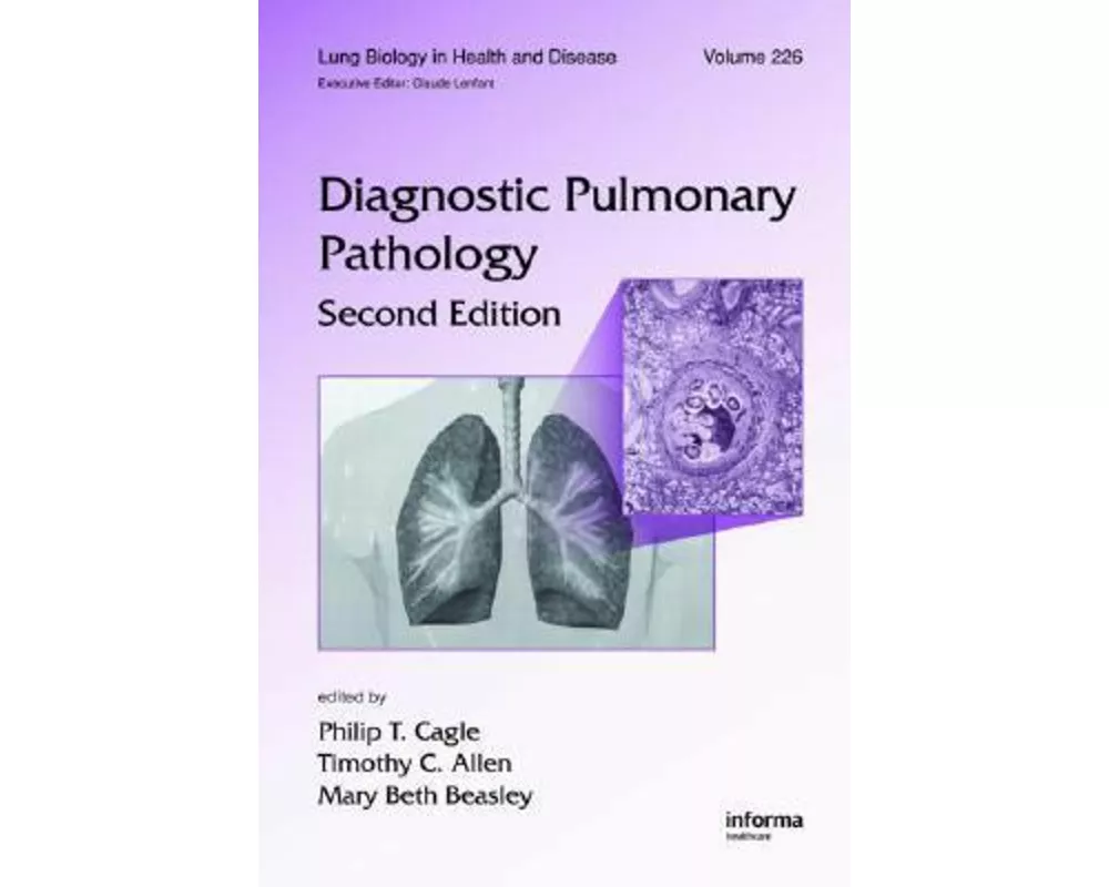 Diagnostic Pulmonary Pathology