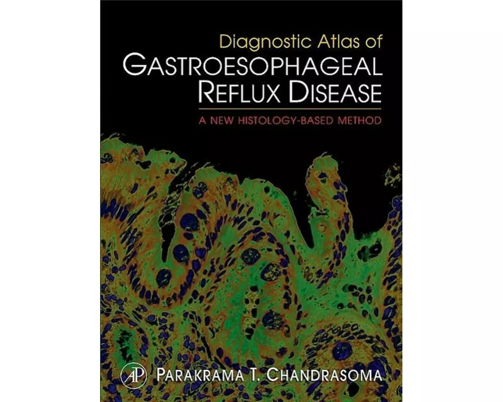 Diagnostic Atlas of Gastroesophageal Reflux Disease