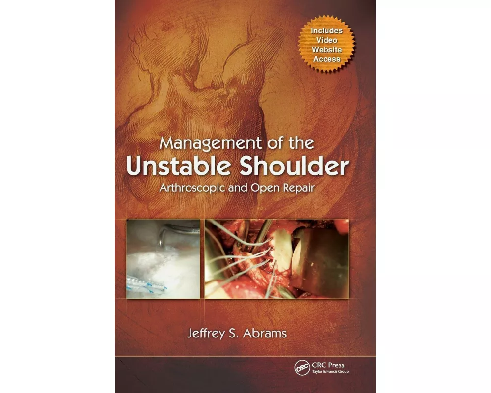 Management of the Unstable Shoulder
