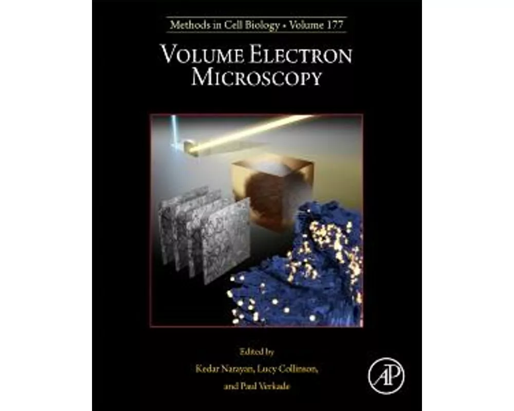 Volume Electron Microscopy: Volume 177