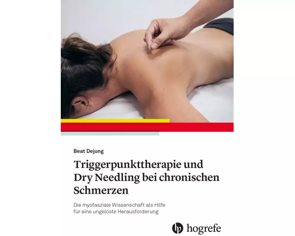 Manuelle Triggerpunkt-Therapie und Dry Needling bei chronischen Schmerzen