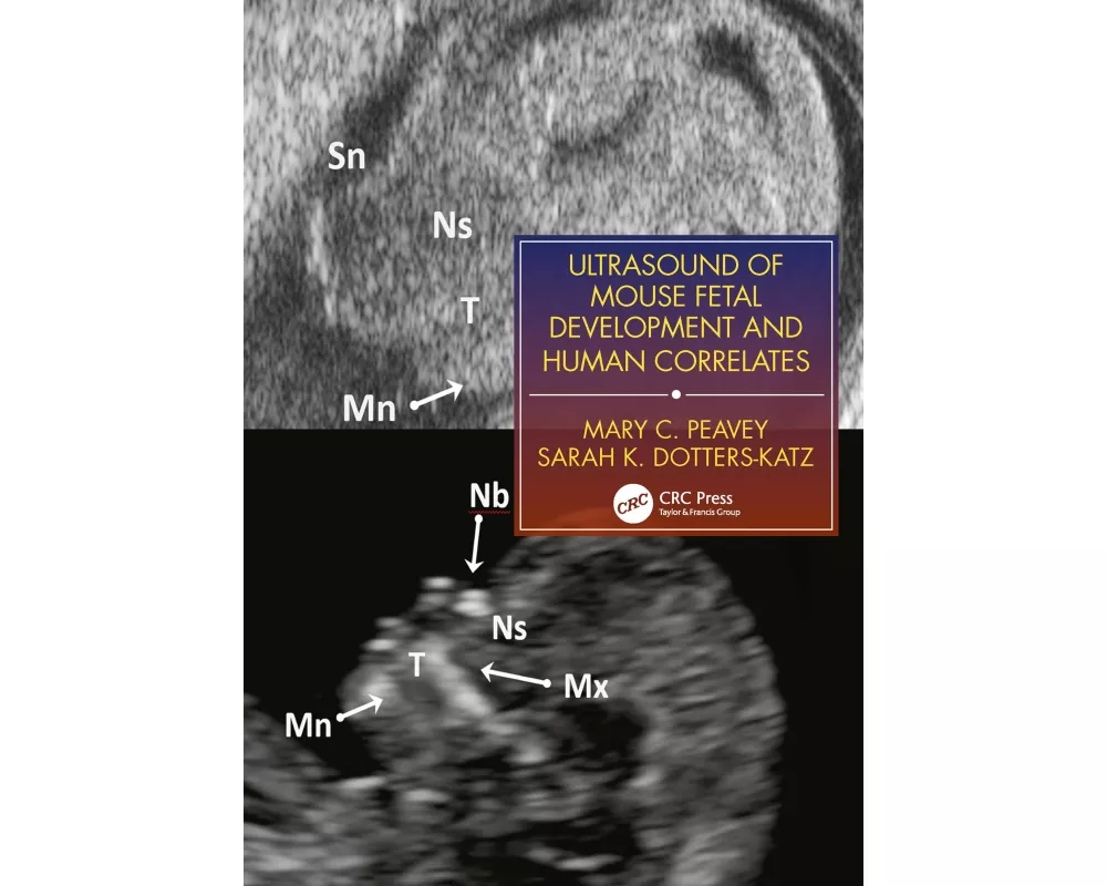 Ultrasound of Mouse Fetal Development and Human Correlates