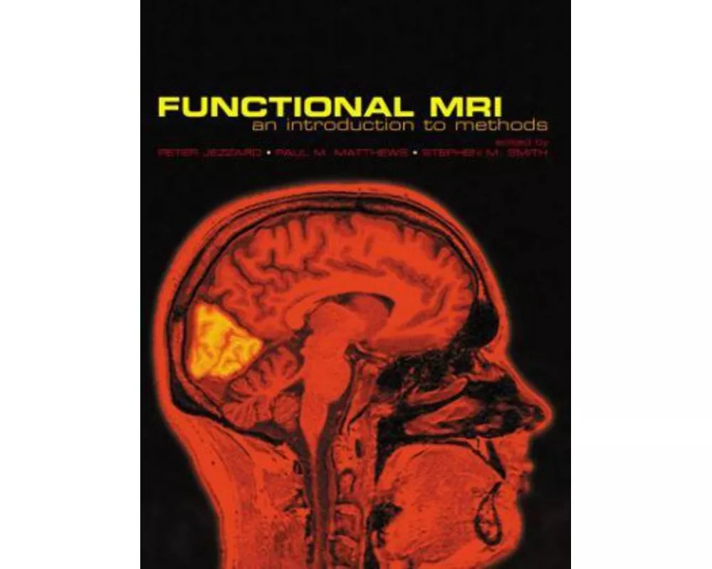 Functional Magnetic Resonance Imaging