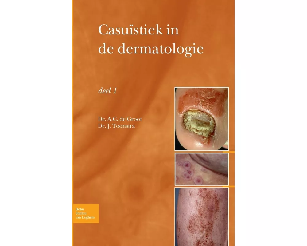 Casuïstiek in de Dermatologie - Deel I
