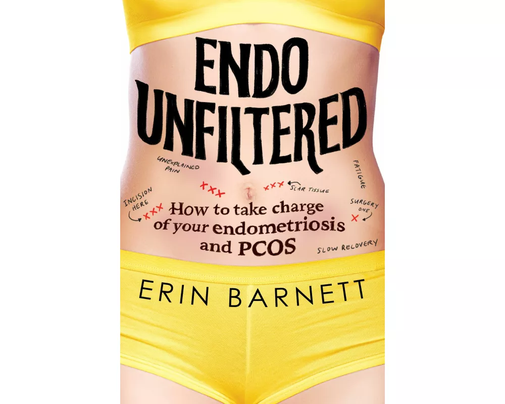 Endo Unfiltered