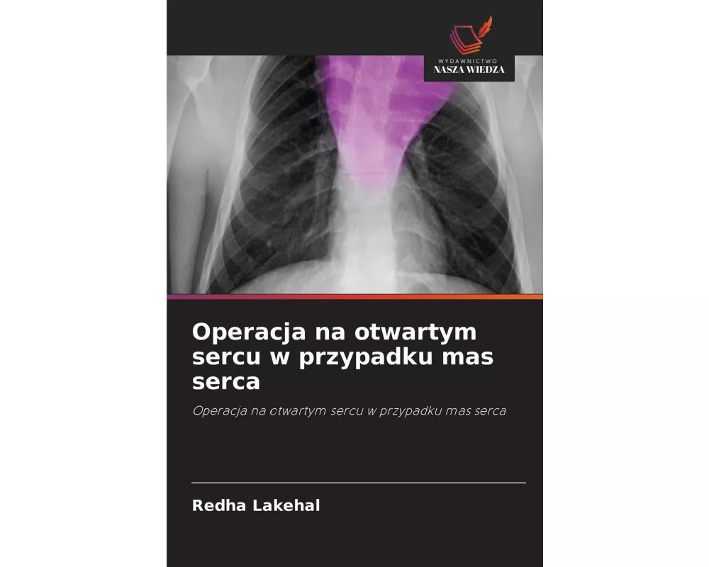 Operacja na otwartym sercu w przypadku mas serca