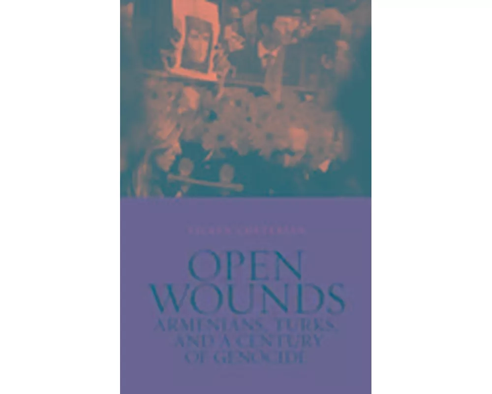 Open Wounds