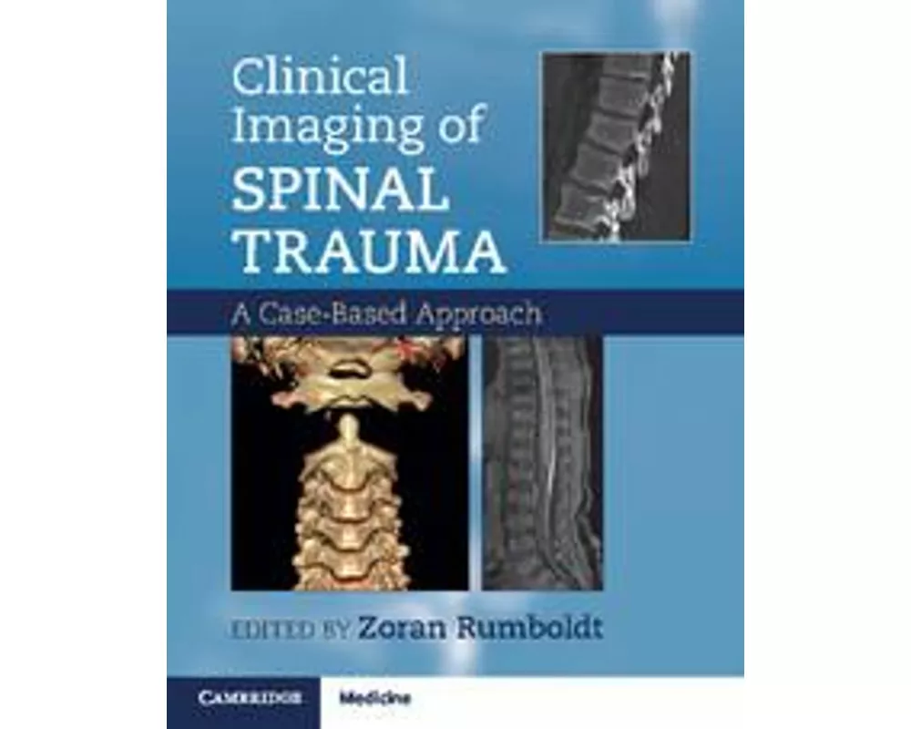 Clinical Imaging of Spinal Trauma