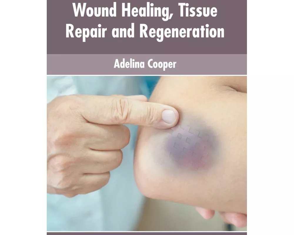 Wound Healing, Tissue Repair and Regeneration