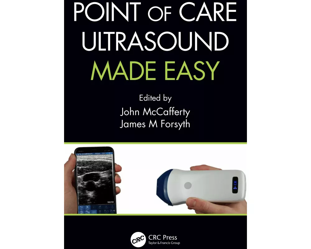 Point of Care Ultrasound Made Easy