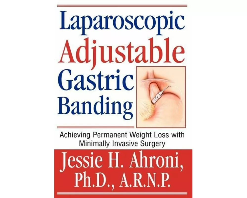 Laparoscopic Adjustable Gastric Banding