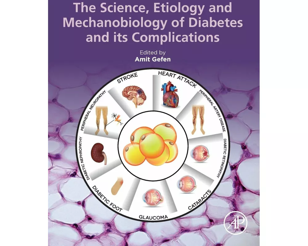 The Science, Etiology and Mechanobiology of Diabetes and Its Complications
