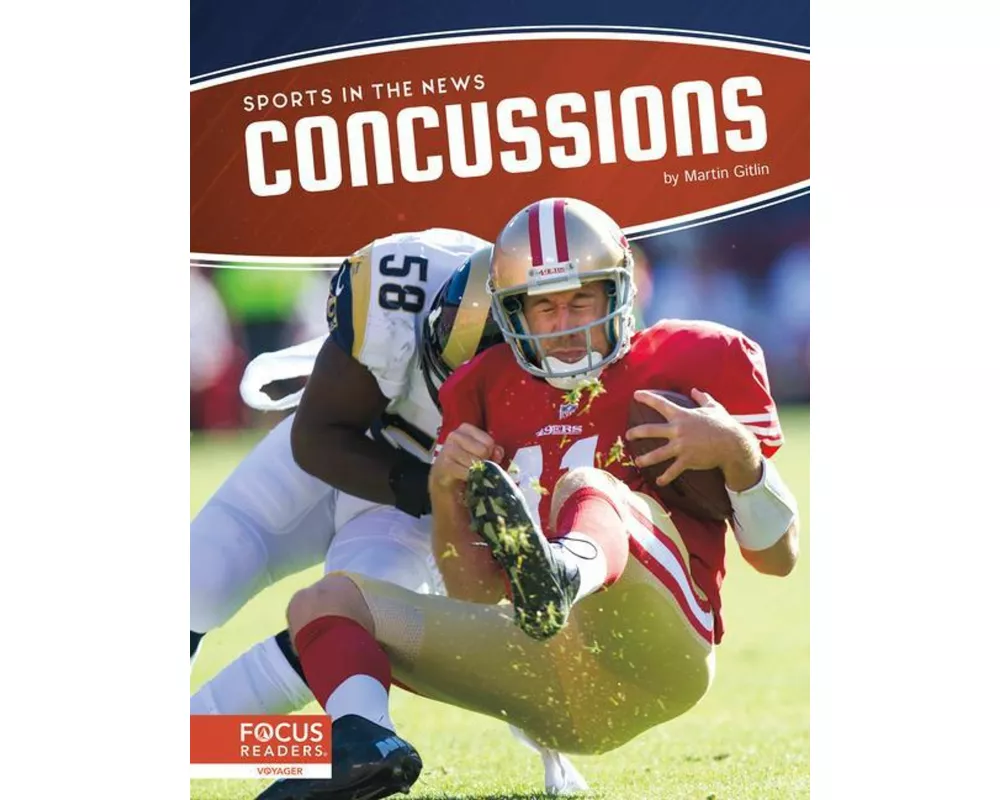 Concussions