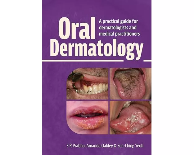 Oral Dermatology