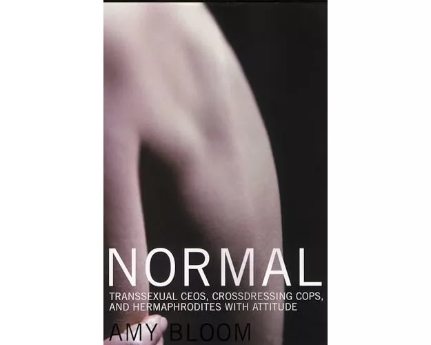 Normal