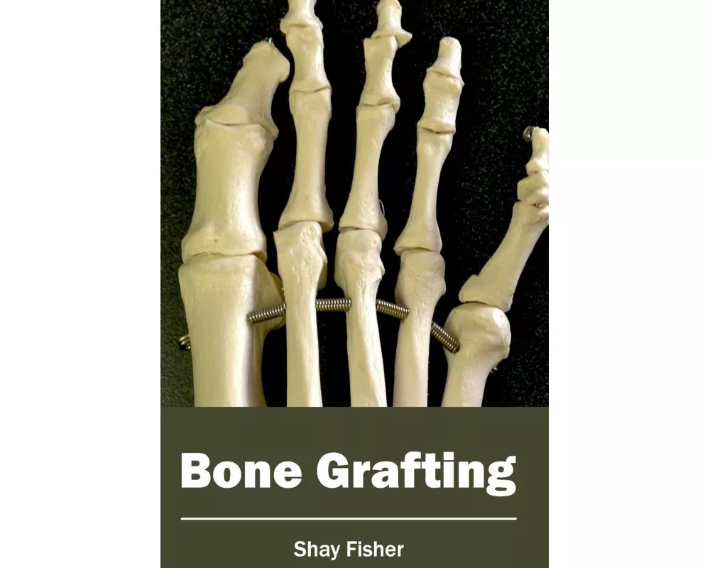 Bone Grafting