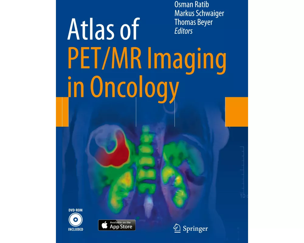 Atlas of PET/MR Imaging in Oncology