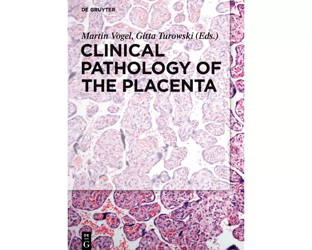 Clinical Pathology of the Placenta