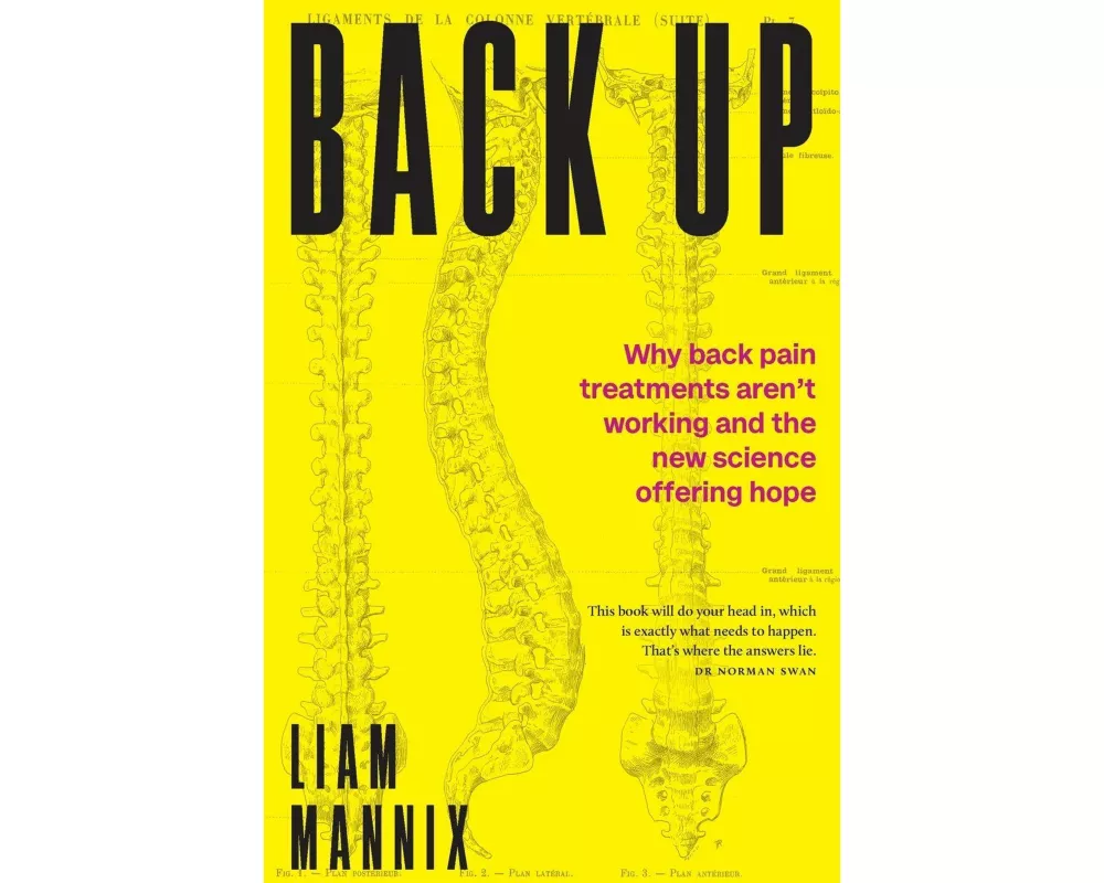 Back Up