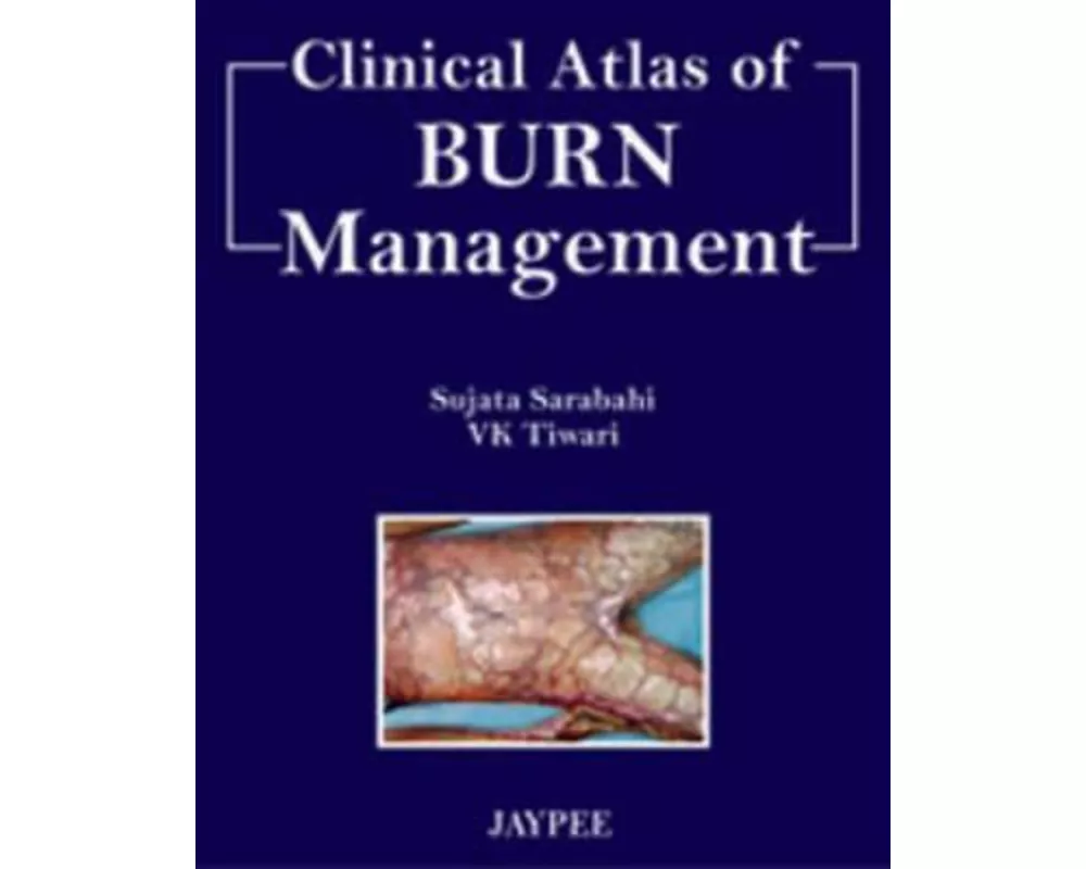 Clinical Atlas of Burn Managment