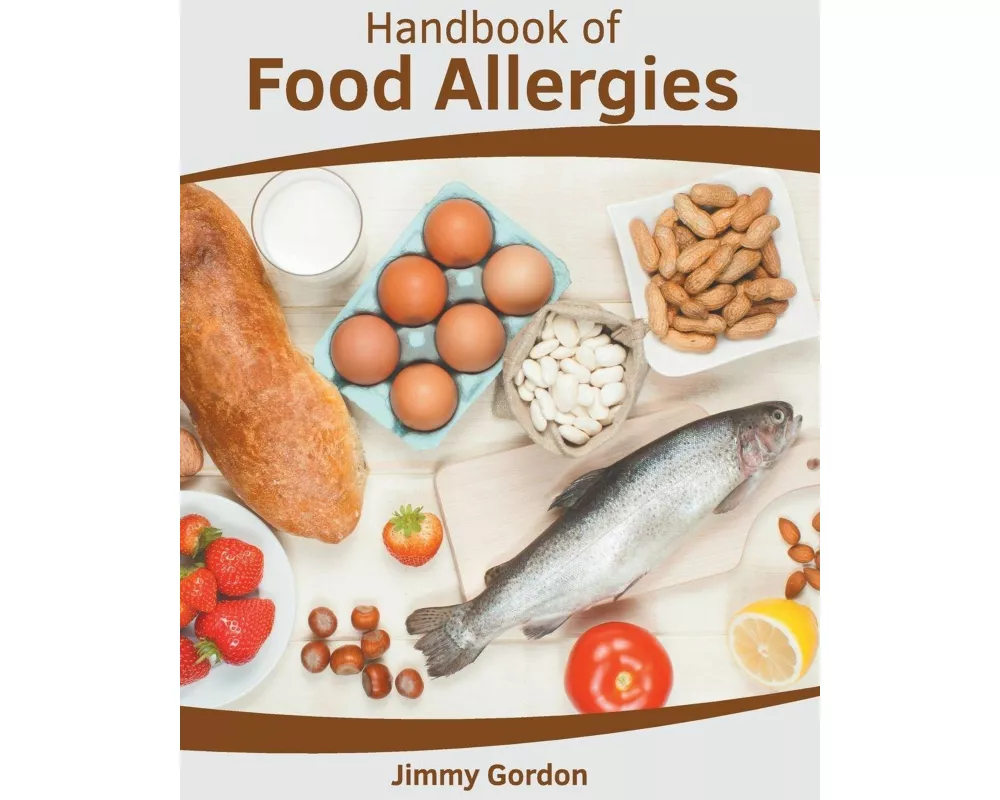 Handbook of Food Allergies
