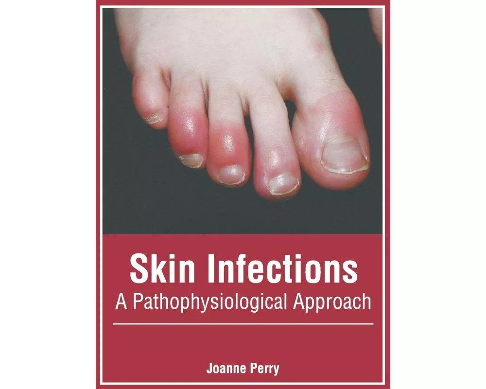 Skin Infections: A Pathophysiological Approach