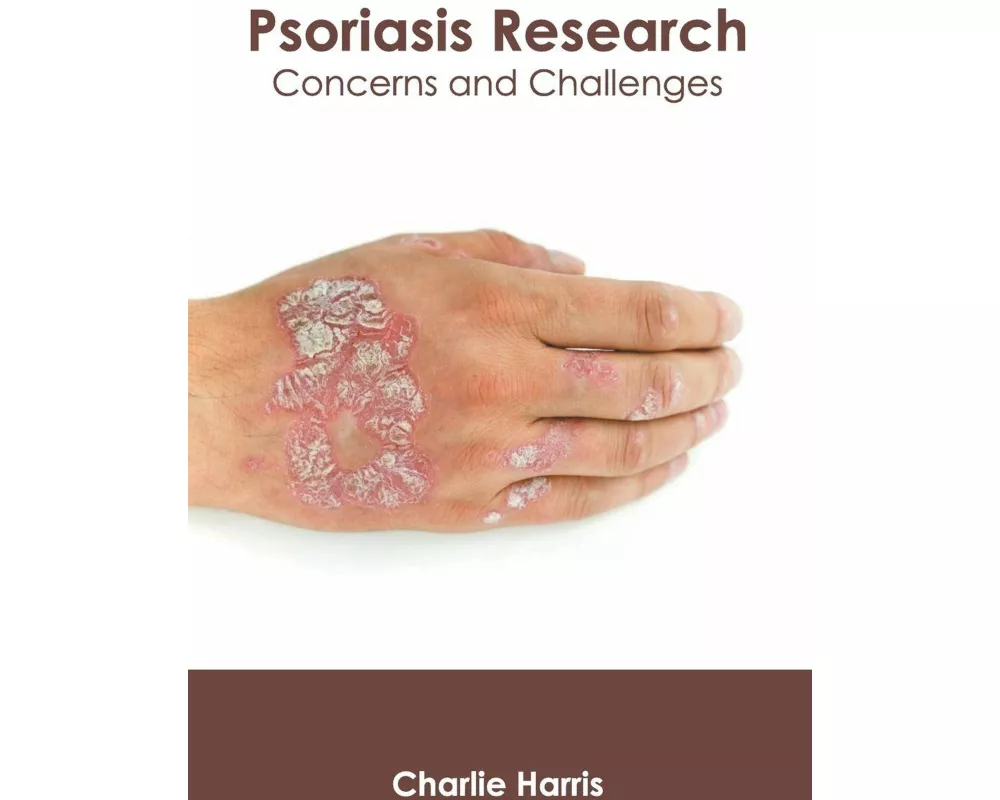 Psoriasis Research: Concerns and Challenges