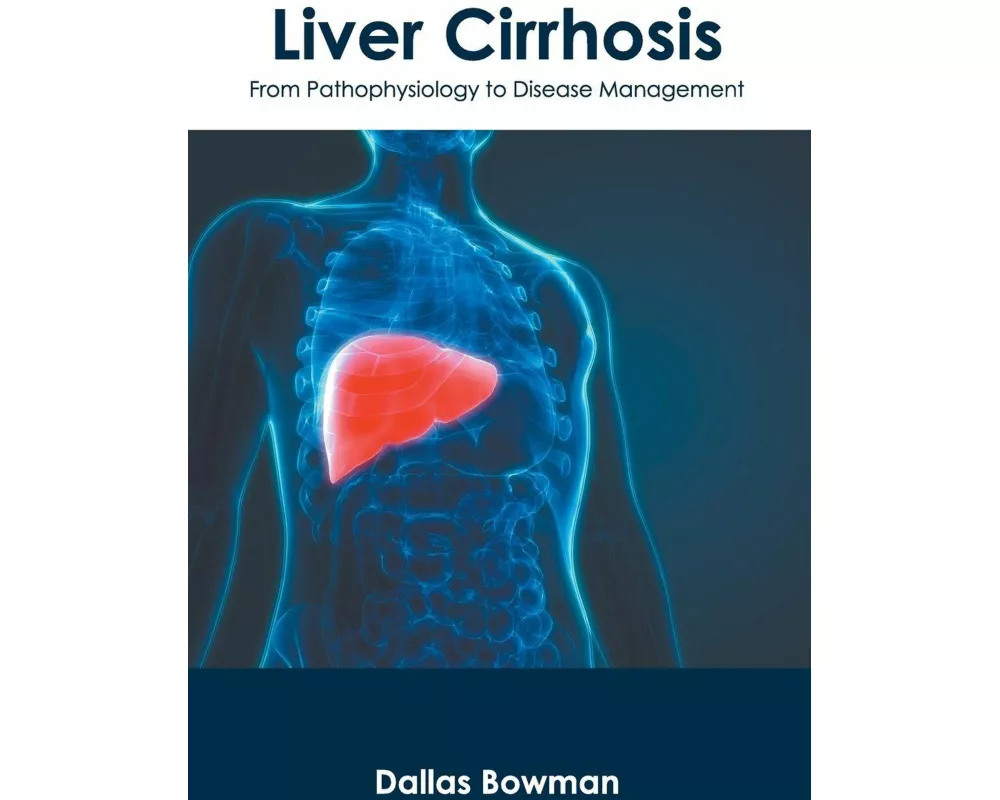 Liver Cirrhosis: From Pathophysiology to Disease Management
