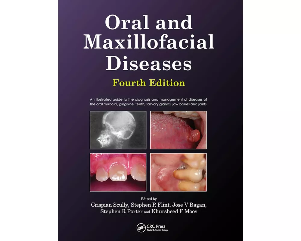 Oral and Maxillofacial Diseases, Fourth Edition