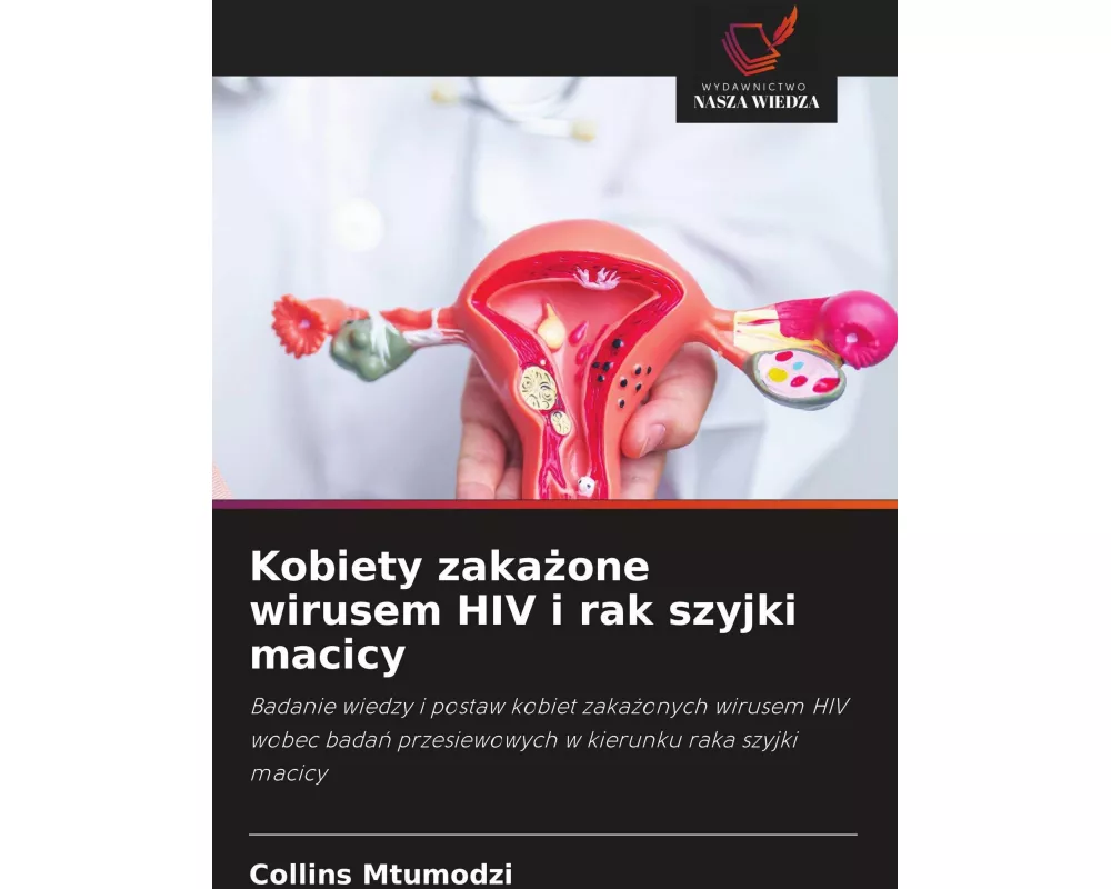 Kobiety zaka¿one wirusem HIV i rak szyjki macicy