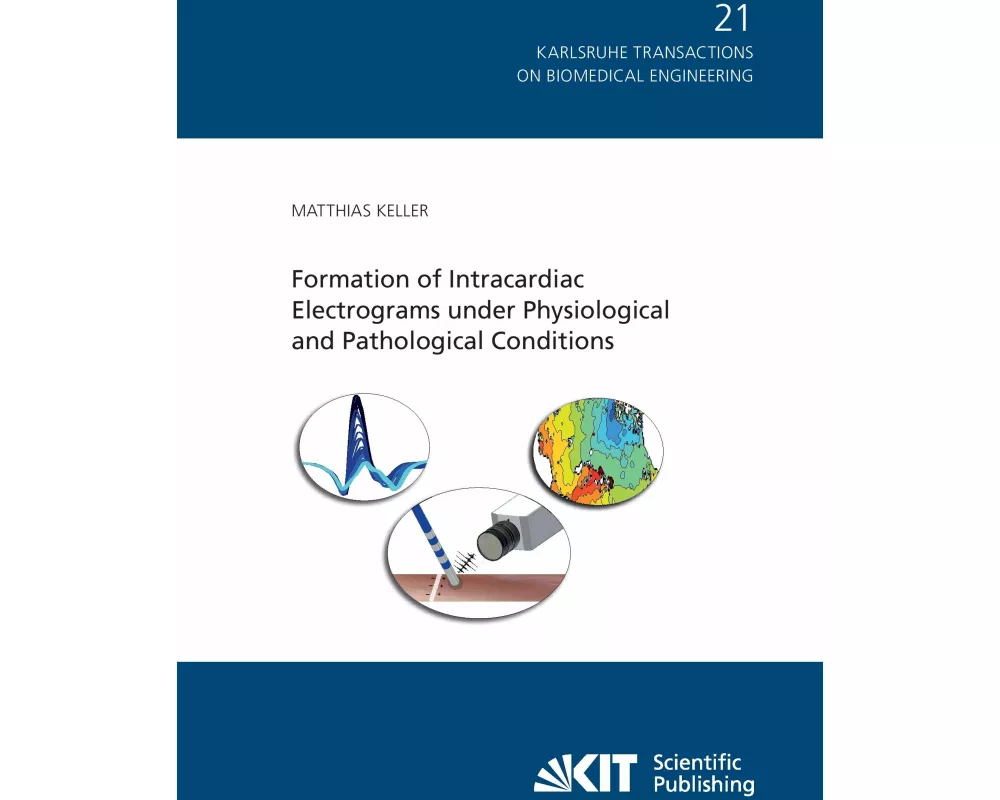 Formation of Intracardiac Electrograms under Physiological and Pathological Conditions