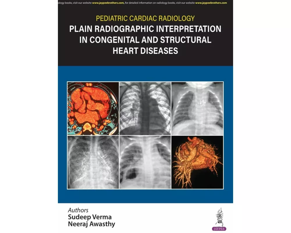 Pediatric Cardiac Radiology