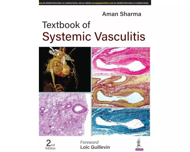 Textbook of Systemic Vasculitis