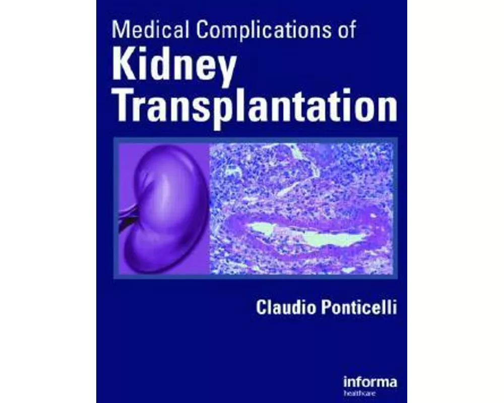 Medical Complications of Kidney Transplantation
